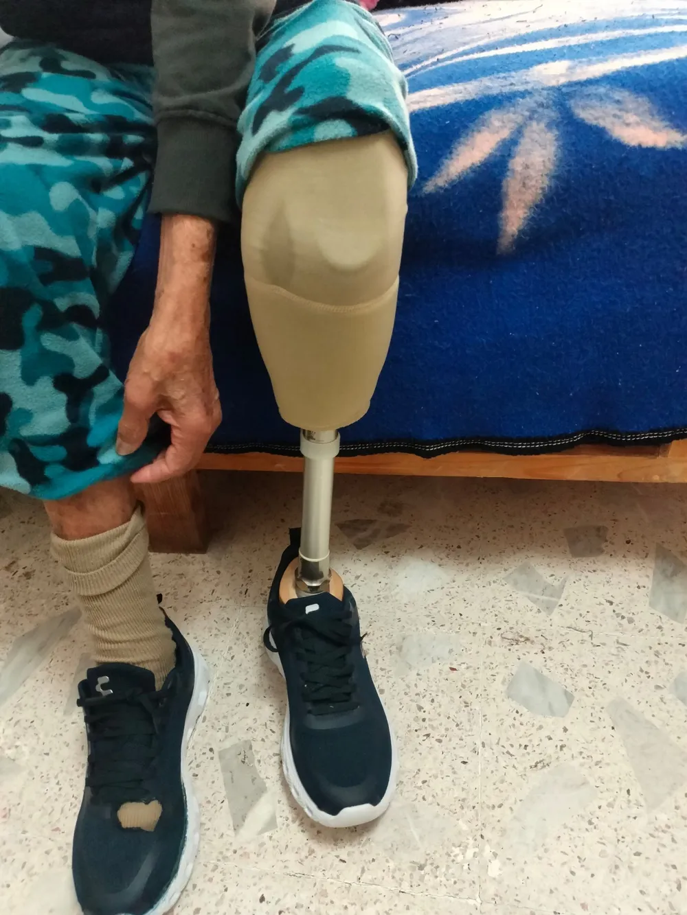 Paciente con prótesis de pierna y tenis sentado en su cama